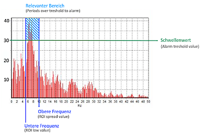 Epilepsie Alarm Einstellung Diagramm